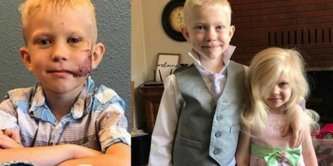 Bridger Walker The Brave Boy Who Saved His Sister and Embraces His Heroic Scar